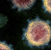 Nova actualització Termes del coronavirus en occità